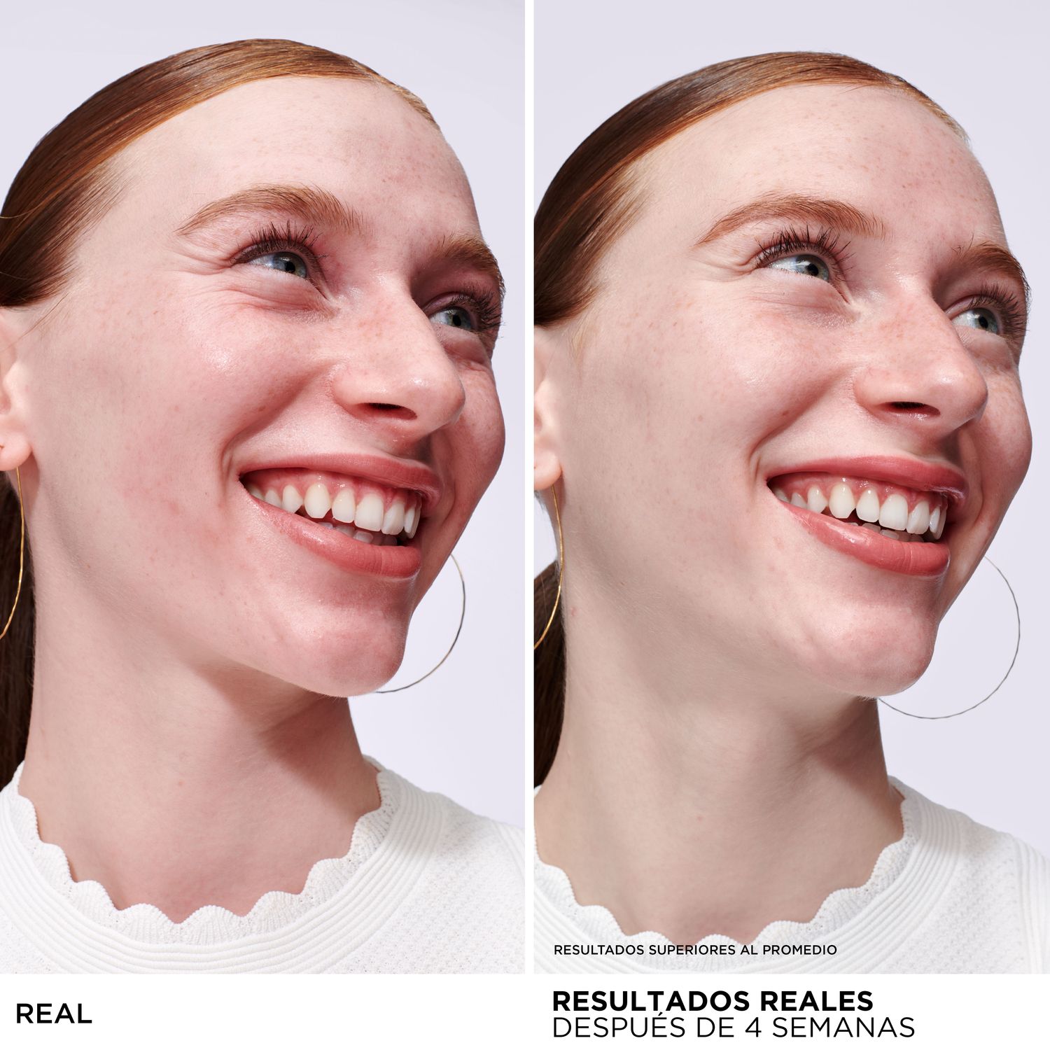 BYE BYE REDNESS (SUERO ANTI-ENROJECIMIENTO)